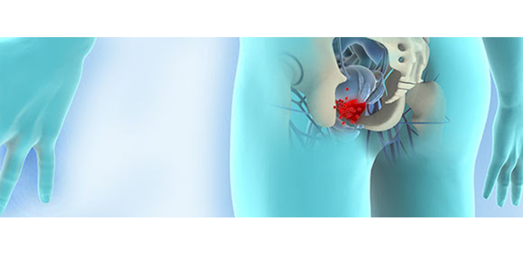 Enrich and detect CTCs of prostate cancer from blood